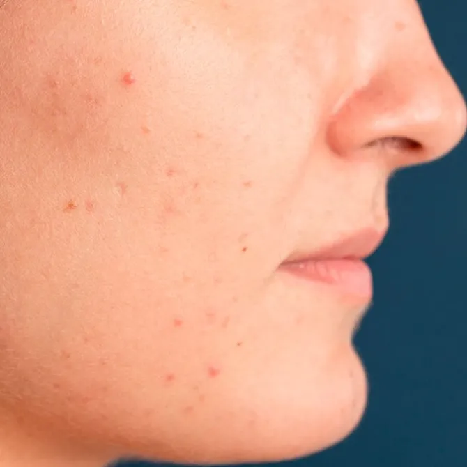 Blue Radiance Enzymatic Serum