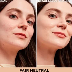 Bye Bye Dark Spots Concealer + Serum