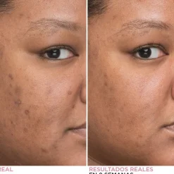 Bye Bye Dark Spots Concentrated Sérum