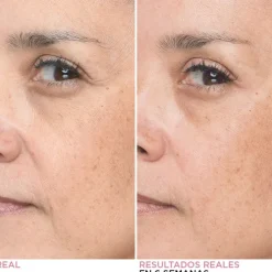 Bye Bye Lines Concentrated Sérum