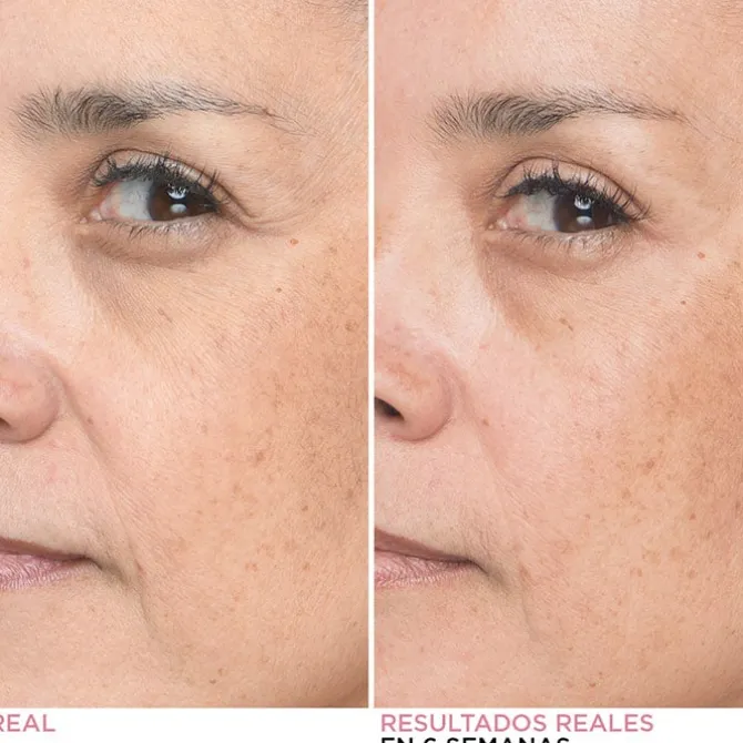 Bye Bye Lines Concentrated Sérum