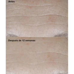 Clinique Smart Clinical Repair SPF30 Wrinkle Correcting Cream