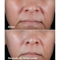 Clinique Smart Clinical Repair Rich Cream