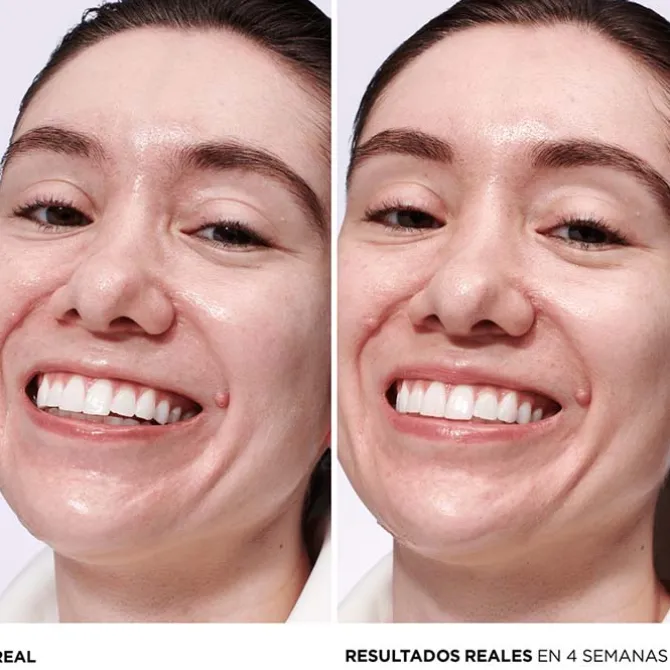 Confidence in a Gel Cream