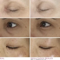 Confidence in an Eye Cream