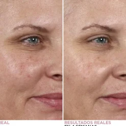 Hello Results Baby-Smooth Glycolic Peel + Caring Oil Sérum