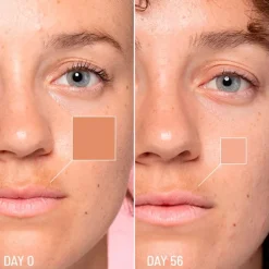 Lotus Radiance Dark Spot Treatment