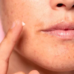 Lotus Radiance Dark Spot Treatment