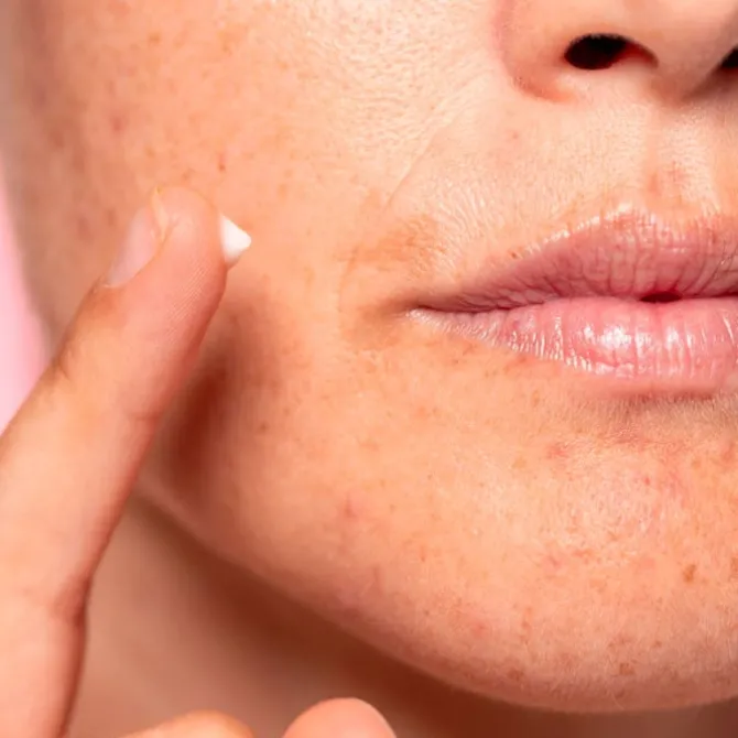 Lotus Radiance Dark Spot Treatment