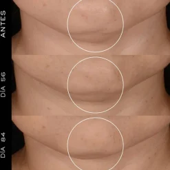 Rénergie H.P.N. 300-Peptide Cream